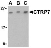 Western blot of CTRP7 in 293 cell lysate with CTRP7 antibody at (A) 0.5, (B) 1, and (C) 2 ug/ml.