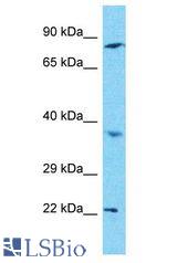 C1orf105 antibody Western Blot of HepG2. Antibody dilution: 1 ug/ml.