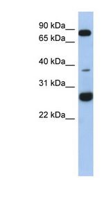 C1orf110 antibody LS-C111702 Western blot of Fetal Heart lysate.