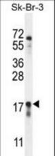 CA115 Antibody western blot of SK-BR-3 cell line lysates (35 ug/lane). The CA115 antibody detected the CA115 protein (arrow).