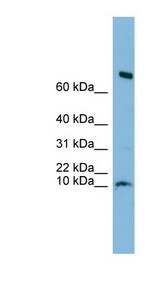 C1orf122 antibody LS-C116547 Western blot of Fetal Heart lysate.