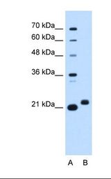 Lane A: Marker. Lane B: HepG2 cell lysate. Antibody concentration: 0.25 ug/ml. Gel concentration: 12%.