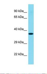 Western blot of Human Hela. C1orf168 antibody dilution 1.0 ug/ml.