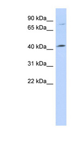 C1orf177 antibody LS-C102511 Western blot of 721_B cell lysate.
