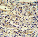 C1orf186 antibody immunohistochemistry of formalin-fixed and paraffin-embedded human kidney tissue followed by peroxidase-conjugated secondary antibody and DAB staining.
