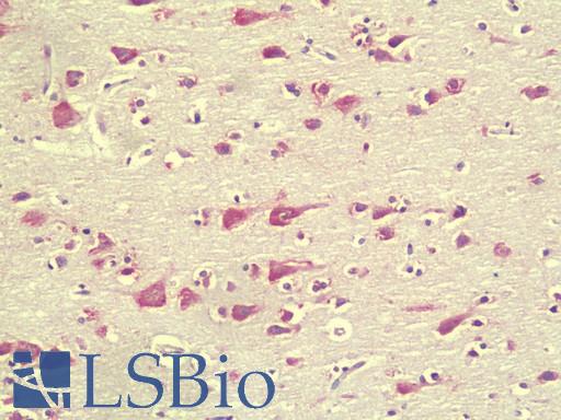Anti-C1orf187 / DRAXIN antibody IHC staining of human brain, cortex. Immunohistochemistry of formalin-fixed, paraffin-embedded tissue after heat-induced antigen retrieval. Antibody LS-B9573 concentration 5 ug/ml.
