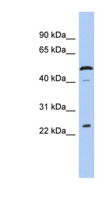 C1orf190 antibody LS-C111837 Western blot of Jurkat lysate.