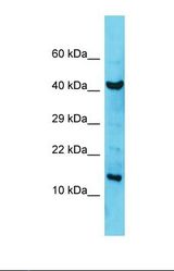 Western blot of Human MCF7. COA6 antibody dilution 1.0 ug/ml.