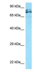 C1orf38 antibody Western Blot of OVCAR-3.