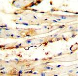 CRCT1 antibody immunohistochemistry of formalin-fixed and paraffin-embedded mouse heart tissue followed by peroxidase-conjugated secondary antibody and DAB staining.