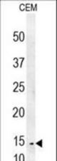CRCT1 Antibody western blot of CEM cell line lysates (35 ug/lane). The CRCT1 antibody detected the CRCT1 protein (arrow).