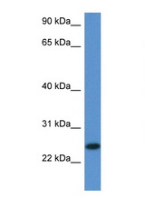 2810405K02Rik antibody LS-C145230 Western blot of Mouse Thymus lysate. Antibody concentration 1 ug/ml.