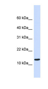 C1orf95 antibody LS-C102101 Western blot of Fetal Heart lysate.