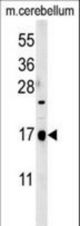 CA095 Antibody western blot of mouse cerebellum tissue lysates (35 ug/lane). The CA095 antibody detected CA095 protein (arrow).