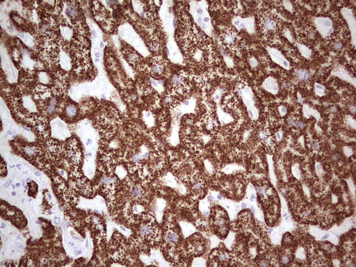 IHC of paraffin-embedded Human liver tissue using anti-ABAT mouse monoclonal antibody. (Heat-induced epitope retrieval by 1 mM EDTA in 10mM Tris, pH8.5, 120°C for 3min).