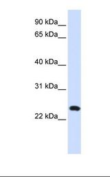 721_B cell lysate. Antibody concentration: 1.0 ug/ml. Gel concentration: 12%.