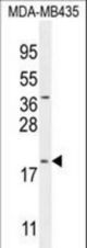 CT173 Antibody western blot of MDA-MB435 cell line lysates (35 ug/lane). The CT173 antibody detected the CT173 protein (arrow).