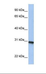 MCF7 cell lysate. Antibody concentration: 1.0 ug/ml. Gel concentration: 12%.