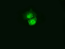 Anti-C21orf59 mouse monoclonal antibody immunofluorescent staining of COS7 cells transiently transfected by pCMV6-ENTRY C21orf59.