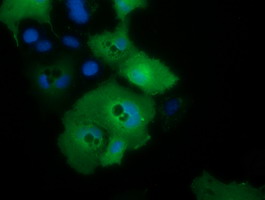 Anti-C21orf59 mouse monoclonal antibody immunofluorescent staining of COS7 cells transiently transfected by pCMV6-ENTRY C21orf59.
