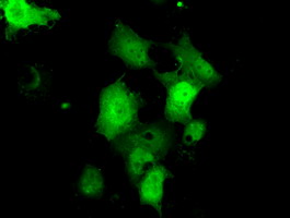 Anti-C21orf59 mouse monoclonal antibody immunofluorescent staining of COS7 cells transiently transfected by pCMV6-ENTRY C21orf59.