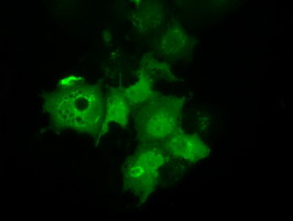 Anti-C21orf59 mouse monoclonal antibody immunofluorescent staining of COS7 cells transiently transfected by pCMV6-ENTRY C21orf59.