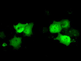 Anti-C21orf59 mouse monoclonal antibody immunofluorescent staining of COS7 cells transiently transfected by pCMV6-ENTRY C21orf59.