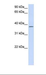 Fetal lung lysate. Antibody concentration: 1.0 ug/ml. Gel concentration: 12%.
