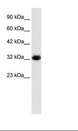 HepG2 Cell Lysate
