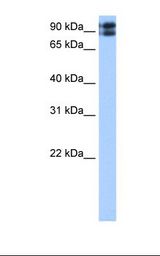 Transfected 293T cell lysate. Antibody concentration: 0.5 ug/ml. Gel concentration: 12%.