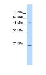Jurkat cell lysate. Antibody concentration: 0.5 ug/ml. Gel concentration: 12%.