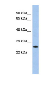 C2orf27B antibody LS-C111781 Western blot of Fetal Lung lysate.