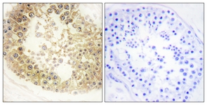 IHC of paraffin-embedded human testis tissue, using ECRG4 Antibody. The picture on the right is treated with the synthesized peptide.