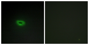 Immunofluorescence of A549 cells, using ECRG4 Antibody. The picture on the right is treated with the synthesized peptide.
