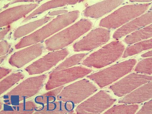 Anti-C2orf40 / ECRG4 antibody IHC staining of human skeletal muscle. Immunohistochemistry of formalin-fixed, paraffin-embedded tissue after heat-induced antigen retrieval. Antibody LS-B9575 concentration 5 ug/ml.