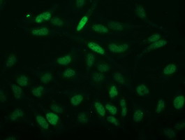 Immunofluorescent staining of HeLa cells using anti-C2orf40 mouse monoclonal antibody.