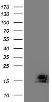 HEK293T cells were transfected with the pCMV6-ENTRY control (Left lane) or pCMV6-ENTRY C2orf40 (Right lane) cDNA for 48 hrs and lysed. Equivalent amounts of cell lysates (5 ug per lane) were separated by SDS-PAGE and immunoblotted with anti-C2orf40.