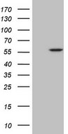 HEK293T cells were transfected with the pCMV6-ENTRY control (Left lane) or pCMV6-ENTRY ABAT (Right lane) cDNA for 48 hrs and lysed. Equivalent amounts of cell lysates (5 ug per lane) were separated by SDS-PAGE and immunoblotted with anti-ABAT.