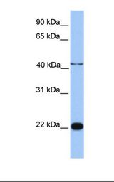 Jurkat cell lysate. Antibody concentration: 1.0 ug/ml. Gel concentration: 12%.