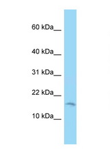 C2orf76 antibody LS-C146211 Western blot of 721_B Cell lysate. Antibody concentration 1 ug/ml.