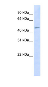 C3orf17 antibody LS-C102137 Western blot of HeLa lysate.