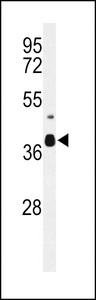 Western blot of CC058 Antibody in mouse cerebellum tissue lysates (35 ug/lane). CC058 (arrow) was detected using the purified antibody.