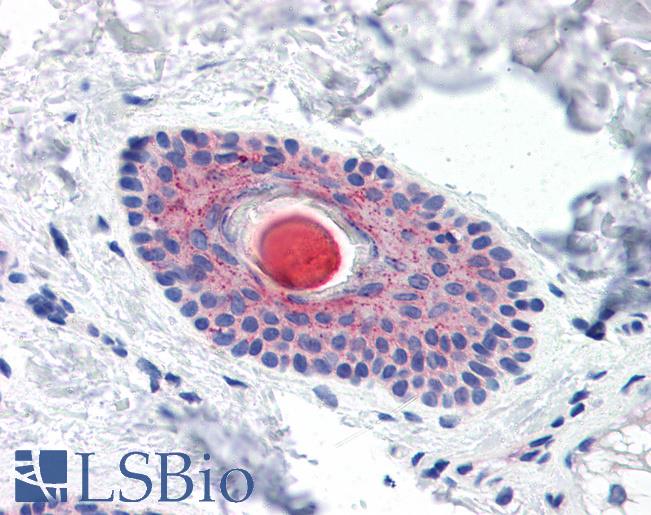 Anti-LYPD3 antibody LS-A9857 IHC of human skin, hair follicle. Immunohistochemistry of formalin-fixed, paraffin-embedded tissue after heat-induced antigen retrieval.