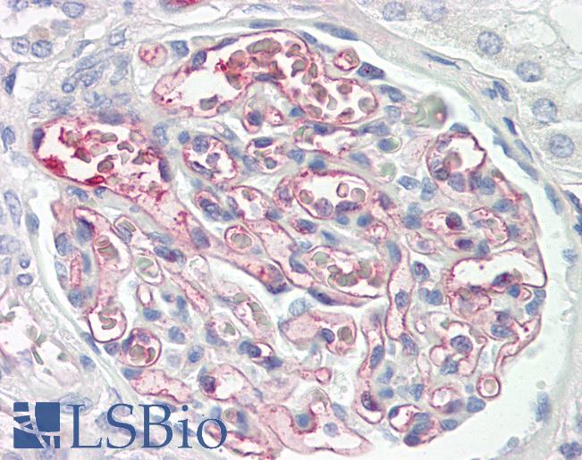 Human Kidney: Formalin-Fixed, Paraffin-Embedded (FFPE)