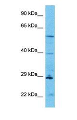 Western blot of C4orf27 Antibody with human HT1080 Whole Cell lysate.
