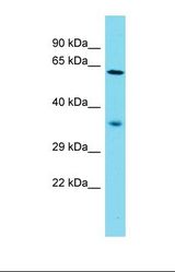 Western blot of Human Jurkat. NDNF antibody dilution 1.0 ug/ml.