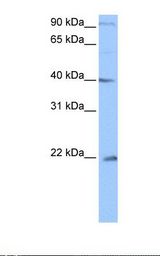Jurkat cell lysate. Antibody concentration: 0.5 ug/ml. Gel concentration: 12%.