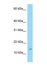 C4orf46 antibody LS-C146210 Western blot of 293T Cell lysate. Antibody concentration 1 ug/ml.