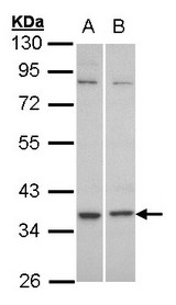 Sample (30 ug of whole cell lysate). A: HeLa, B: Molt-4 . 10% SDS PAGE. C5L2 antibody diluted at 1:1000
