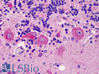 Anti-C5L2 antibody IHC of human brain, cerebellum. Immunohistochemistry of formalin-fixed, paraffin-embedded tissue after heat-induced antigen retrieval. Antibody LS-B1778 concentration 10 ug/ml.